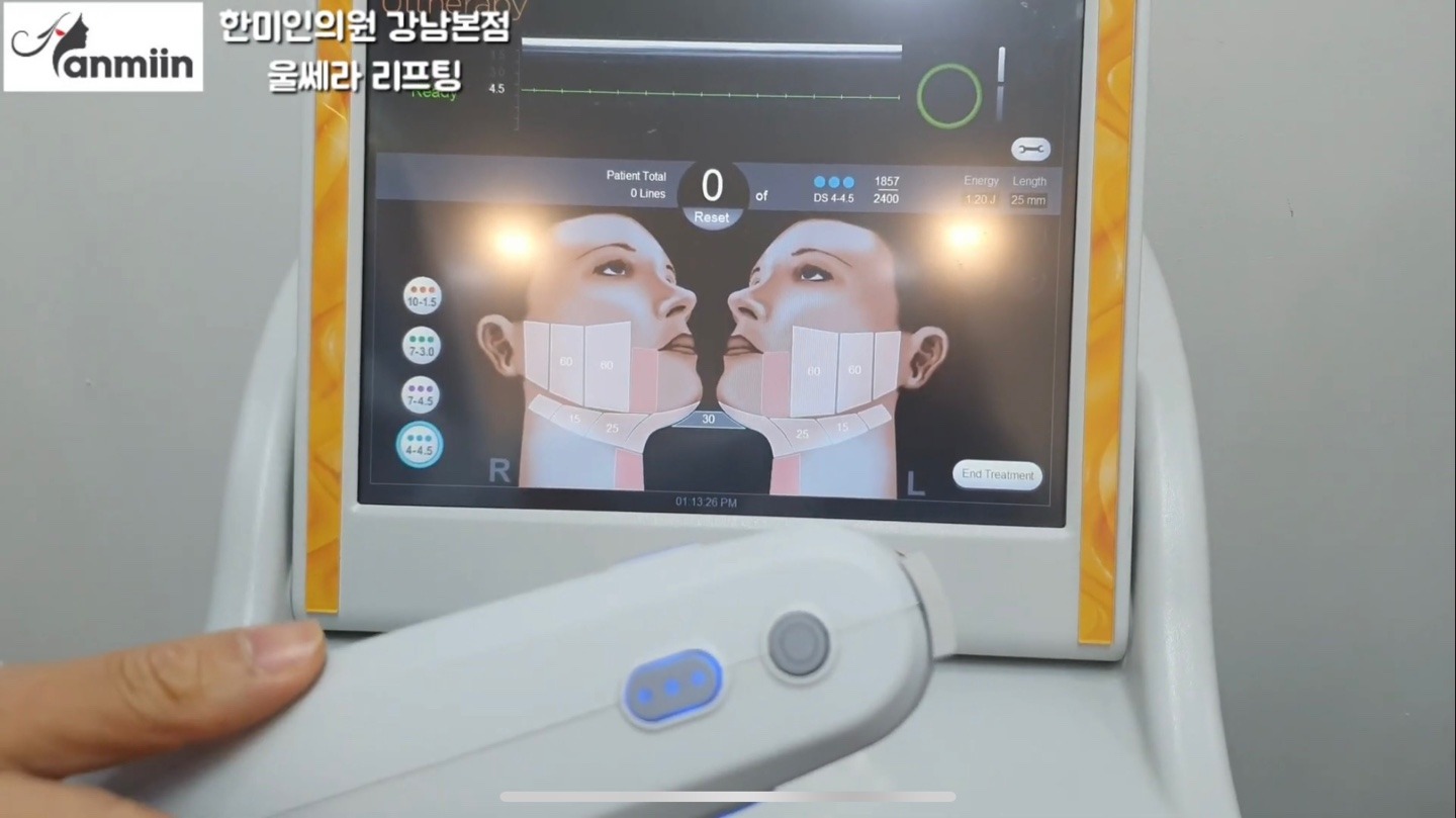 울쎄라리프팅 시술